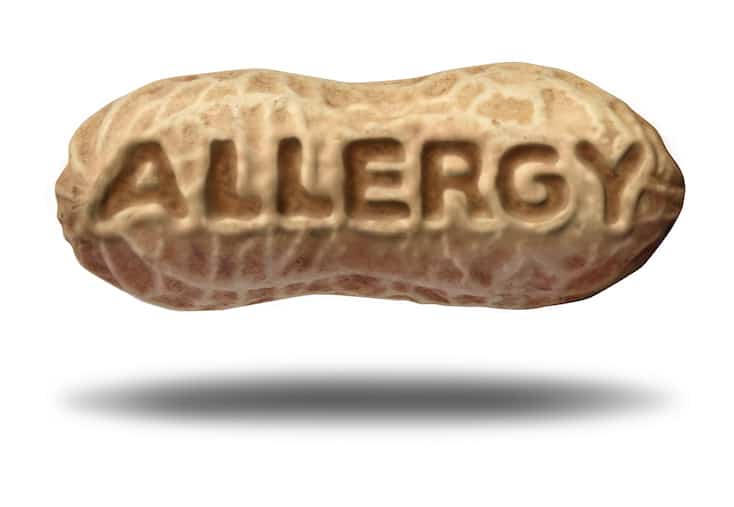 Are you concerned about when and how to give your children peanuts? Or maybe eggs? Do you hear different recommendations from friends and family members? Here are the most recent expert recommendations on your best chance to prevent food allergies in your kids. #foodallergies #peanuts #babynutrition